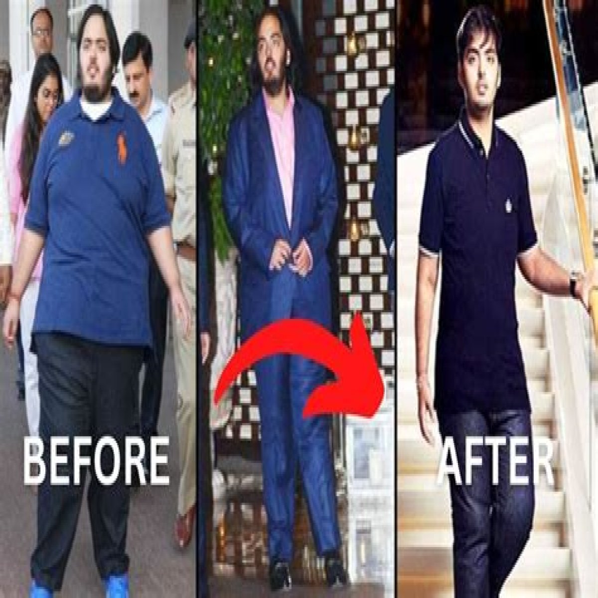 Anant Ambani's Health Journey: Understanding His Illness