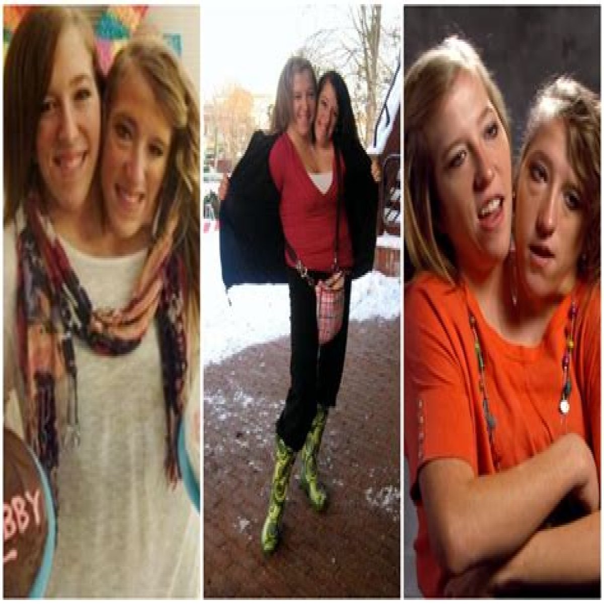 Tragic End: The Mystery Surrounding Abby And Brittany Hensel's Cause Of Death
